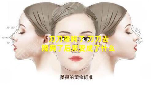 刀刀隆胸了 刀刀去隆胸了后来变成了什么